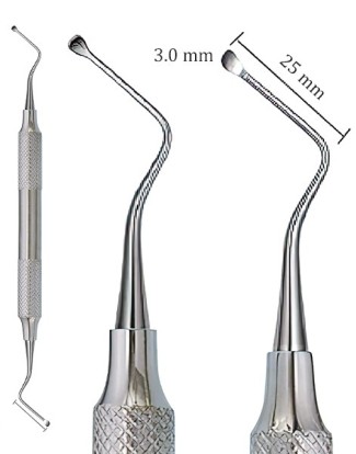 Ложка кюретажная Miller 25 мм-3,0 мм (полая ручка) TW6-189, Truewin / Пакистан